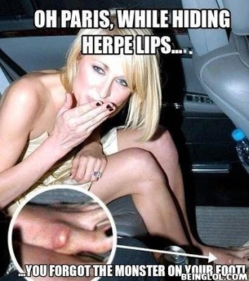 Oh Paris Hilton You Can Hide the Lips But You Forgot About