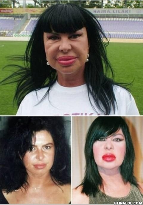 Plastic Surgery Went Horribly Wrong