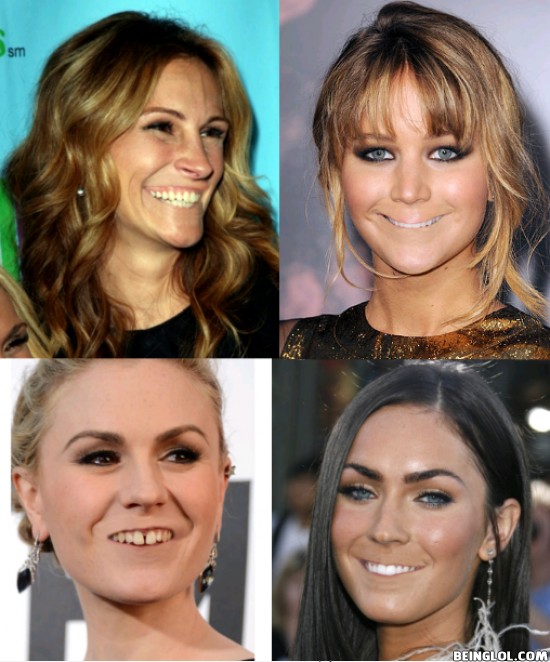 Celebrities Without Lips