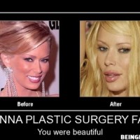 Jenna Plastic Surgery Fail !