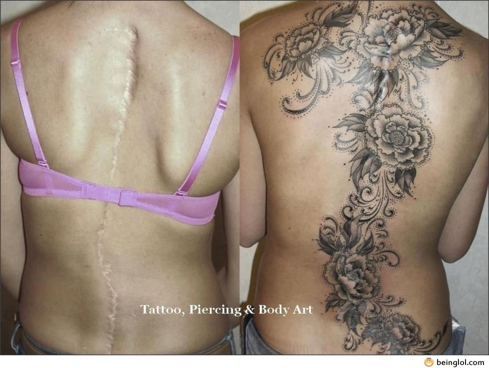 Very Pretty Tattoo Covers Horrible Full Length Back Scar