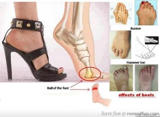 Effects of Wearing Heels