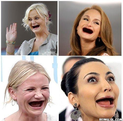 Actresses Without Teeth