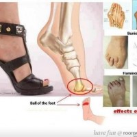 Effects Of Wearing Heels