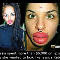 Did You Know That A Russian Girl Spent More Than $6k On Lip Injections Because She Wanted To…