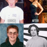 Before and After Puberty Wins!